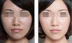 黑臉娃娃適合人群 做黑臉娃娃成好嗎