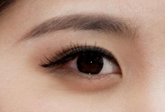 雙眼皮失敗修復手術注意事項有哪些