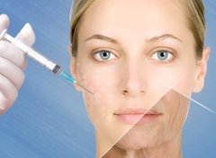 玻尿酸除皺之后應(yīng)該怎么護(hù)理？