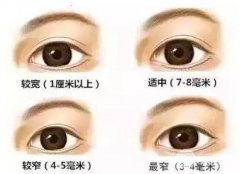 整形專家介紹：雙眼皮修復都有哪些原因？