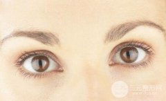 雙眼皮沒(méi)割好能馬上修復(fù)嗎？