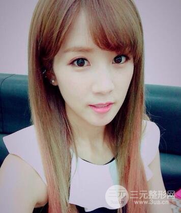 自體軟骨隆鼻尖果如何?