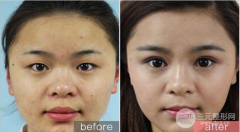 黑臉娃娃貴嗎？有哪些優(yōu)勢？