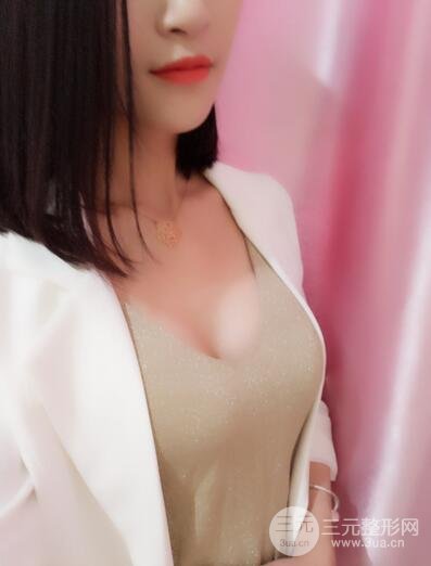 曼托假體+自體脂肪豐胸前后對(duì)比 重慶軍美打造果凍胸