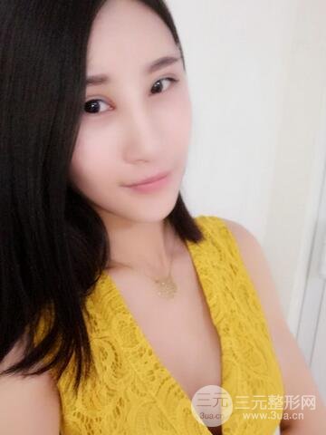 曼托假體+自體脂肪豐胸前后對(duì)比 重慶軍美打造果凍胸