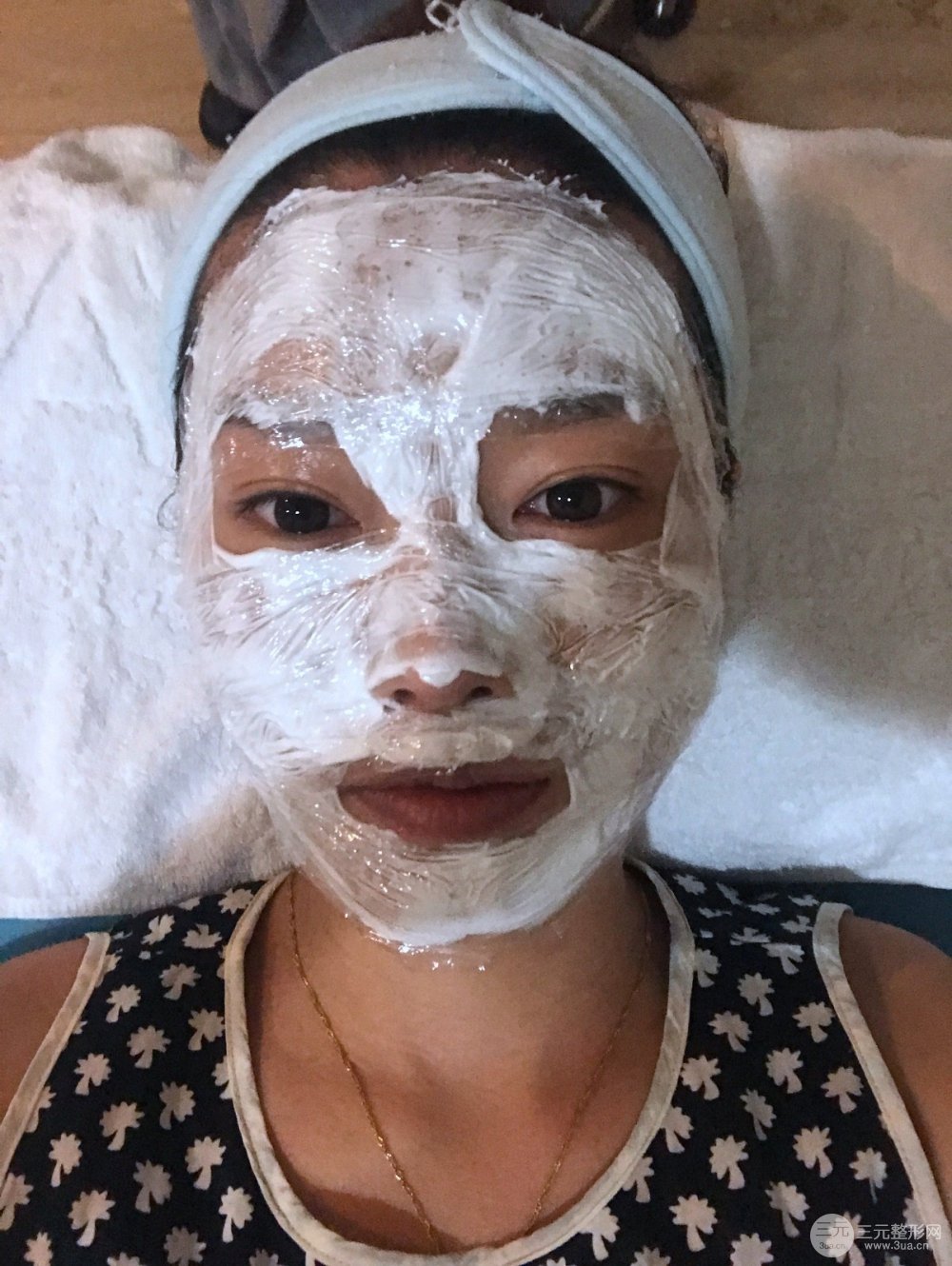 南昌永康整形打水光補(bǔ)水果圖前后對(duì)比