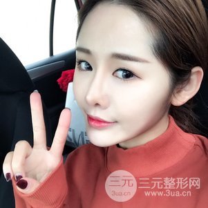 南京米尚恩陳天杰自體脂肪填充全臉 女神的養(yǎng)成記！