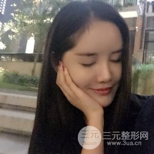 南京米尚恩陳天杰自體脂肪填充全臉 女神的養(yǎng)成記！