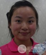 黑臉娃娃嫩膚術案例分享：變白的過程是先讓自己變黑