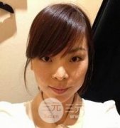 鋸齒.線面b提升術(shù)前后對(duì)比圖分享，讓您返老還童不是夢(mèng)！