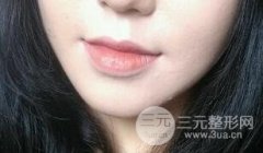 伊w蘭豐下巴前后果展示圖，與V臉就差一個(gè)下巴的距離！