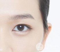 益陽開眼角手術(shù)費用要多少錢