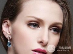 什么是開眼角手術(shù) 開眼角手術(shù)多少錢