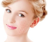 thermage電波l皮緩解一次多少錢(qián)