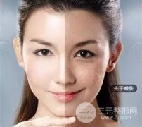 光子嫩膚大概需要多少錢？附IPL嫩膚案例果對比圖片分享~