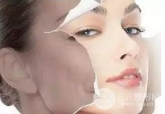 解析:彩光嫩膚要多少錢？功和果維持的時間大揭秘