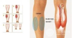 注射瘦腿多少錢一針？打幾次能保持永.久？附真實(shí)案例圖片