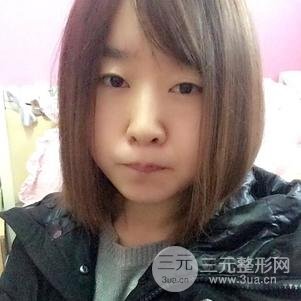 割雙眼皮案例和恢復(fù)過(guò)程真人分享