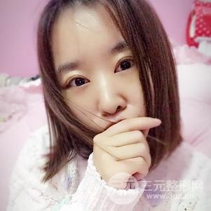 割雙眼皮案例和恢復(fù)過(guò)程真人分享