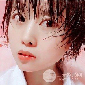 割雙眼皮案例和恢復(fù)過(guò)程真人分享