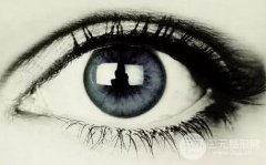 開眼角一般多少錢？成都趙博士雙眼皮案例真實果分享~