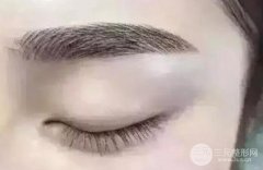 繡眉要多少錢?繡眉對(duì)身體有傷害嗎?