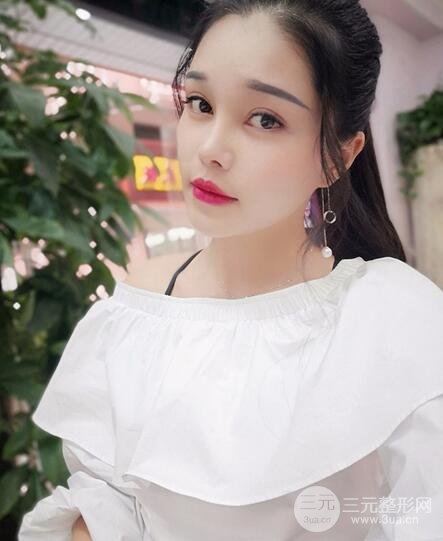 鼻頭縮小術(shù)過(guò)程圖,鼻頭縮小恢復(fù)日記