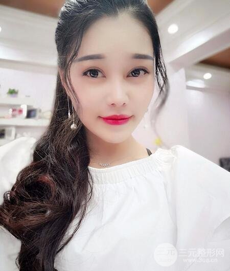 鼻頭縮小術(shù)過(guò)程圖,鼻頭縮小恢復(fù)日記