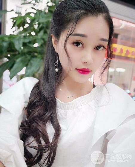 鼻頭縮小術(shù)過(guò)程圖,鼻頭縮小恢復(fù)日記