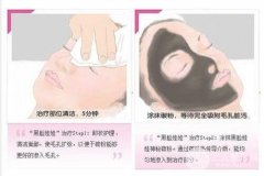 黑臉娃娃有什么作用？什么是黑臉娃娃美容？