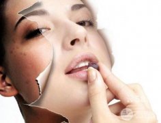 像素激光美容PK光子嫩膚?誰好?