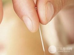 埋線(xiàn)后注意事項(xiàng)