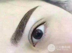 洗眉什么方法喜歡？激光洗眉的價(jià)格是多少？有什么注意事項(xiàng)？