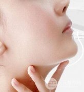 假體墊下巴注意事項(xiàng)