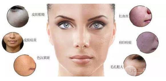 光子嫩膚有果嗎？光子嫩膚做幾次才有果？