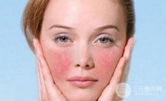 彩光祛紅血絲要多少錢價格貴不貴