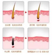 怎么去唇毛 激光去除唇毛怎么樣 價(jià)格貴不貴