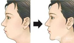 伊w蘭好不好?豐下巴果怎么樣?