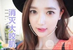 注射瘦臉瘦臉一針要多少錢 適合哪種臉型