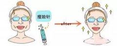 貴州注射瘦臉B****價格表 多久見