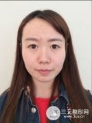 打玻尿酸后注意什么？真人注射過(guò)程果圖片