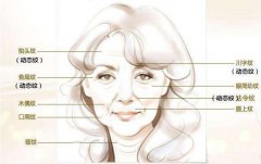 一針除皺多少錢 注射瘦臉除皺果好不好