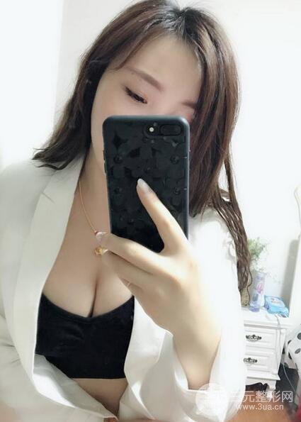 自體脂肪豐胸3個(gè)月分享，活細(xì)胞豐胸術(shù)后果逼真更自然