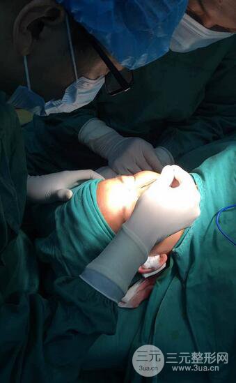 隆鼻鼻翼縮小全過程和術(shù)后照片分享，隨意揉捏很OK