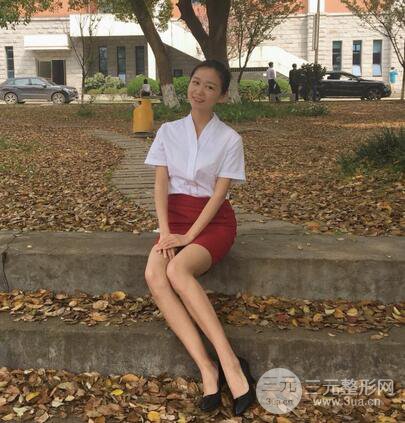 芭比電雙眼皮多項(xiàng)整形術(shù)后分享，雙眼皮拯救死魚眼！