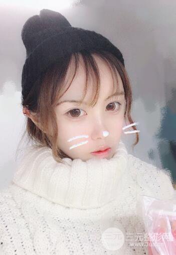 自體脂肪填充全臉基本換臉，改臉型不只是磨骨才能做到！