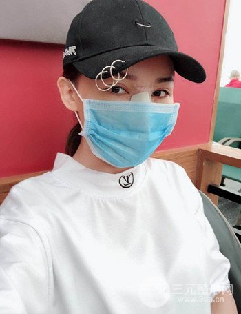 上海隆鼻失敗手術(shù)修復(fù)果超乎想象、前后對(duì)比照片分享