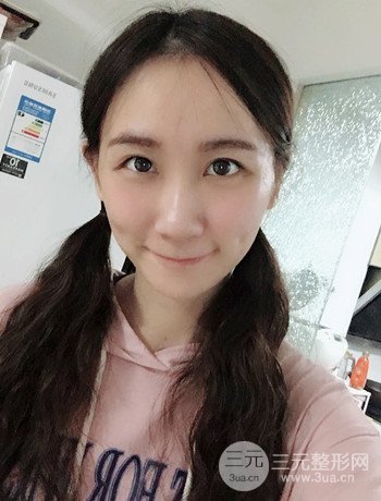 面部埋埋蛋白線.提升改良皮膚松弛，立現(xiàn)小V臉