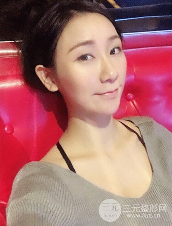 面部埋埋蛋白線.提升改良皮膚松弛，立現(xiàn)小V臉