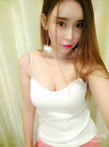 自體脂肪豐胸案例